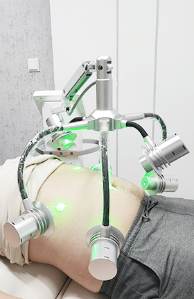 532nm green laser slimming device