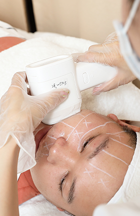Face lifting