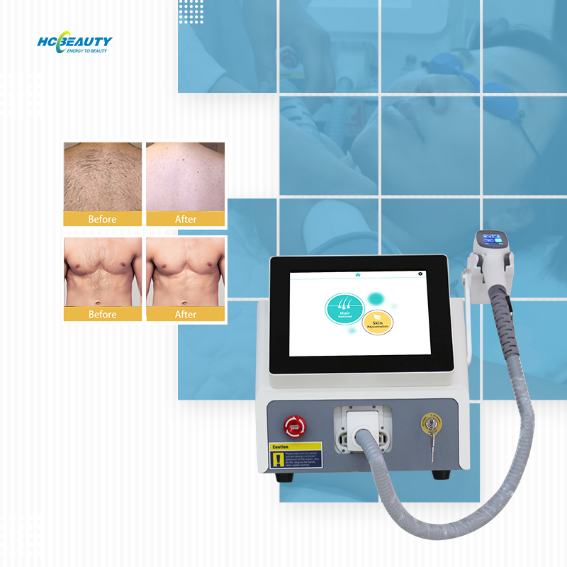 All Colors Treatment Laser Therapy for Hair Removal