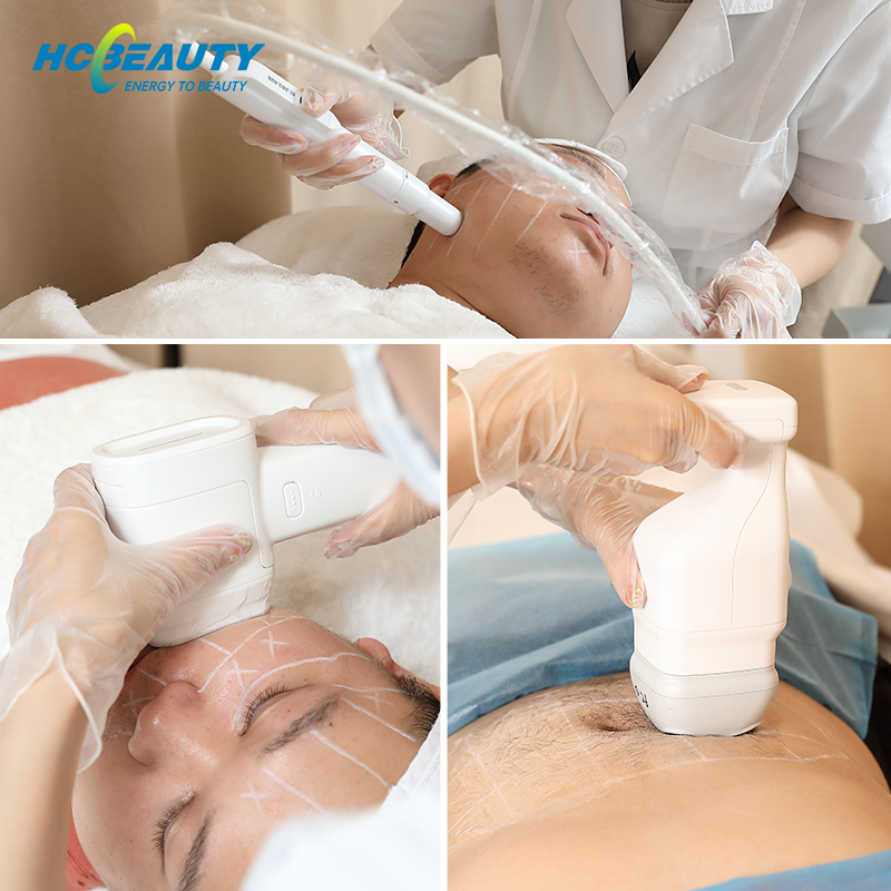 Hifu Skin Machine for Face And Neck