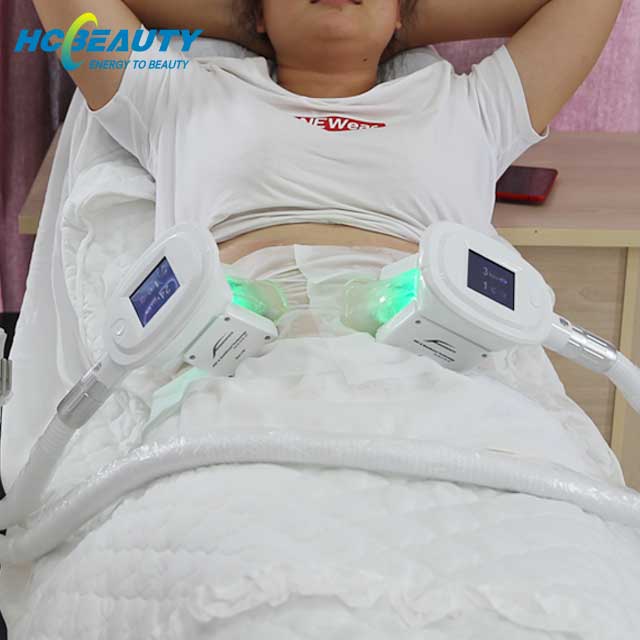 fat freeze priced to go cryolipolysis machine for sale