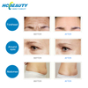 3d hifu body slimming skin rejuvenation 11 lines with ce